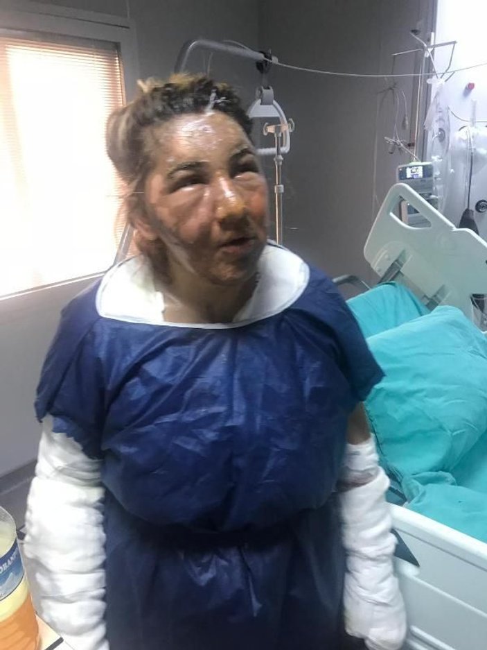 İstanbul'da cezaevinden çıkıp eski karısının yüzünü yaktı