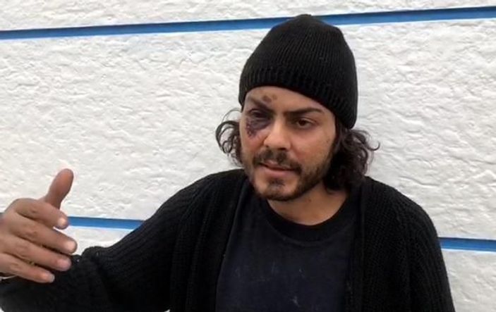 d Mısırlı göçmen: Yunan askerleri demir çubukla dövdü -4