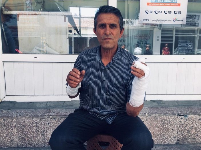 Yozgat’ta ayının saldırısına uğrayan adam yaralandı -2