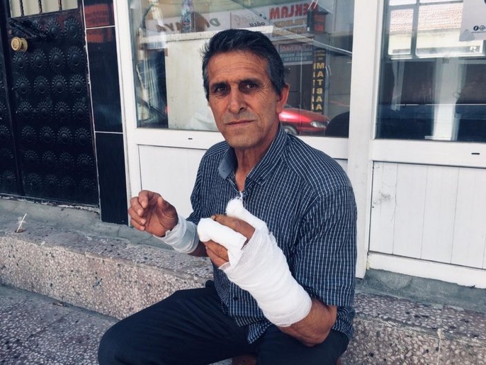 Yozgat’ta ayının saldırısına uğrayan adam yaralandı -1