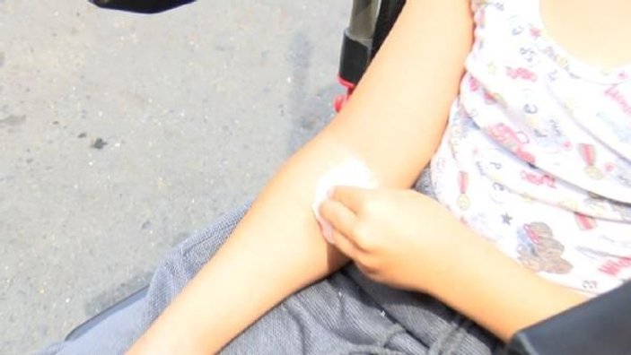 Bacağı kırılan 7 yaşındaki Efe kazayı anlattı    -3