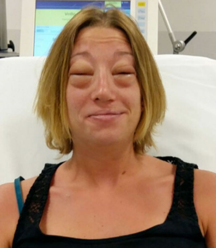 d Eşek sütünde ölüm riski