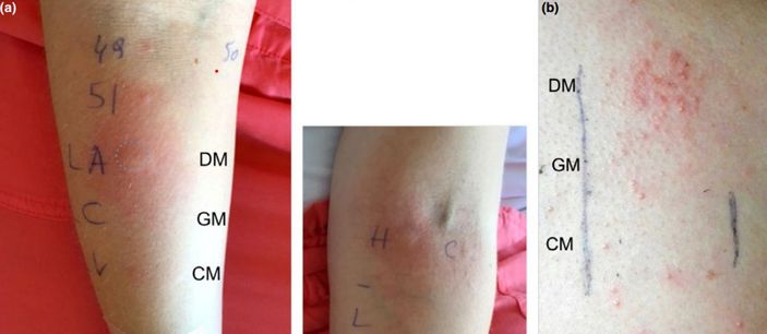 Eşek sütünde ölüm riski