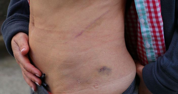 Ankara'da eşinden şiddet gören Rus kadın