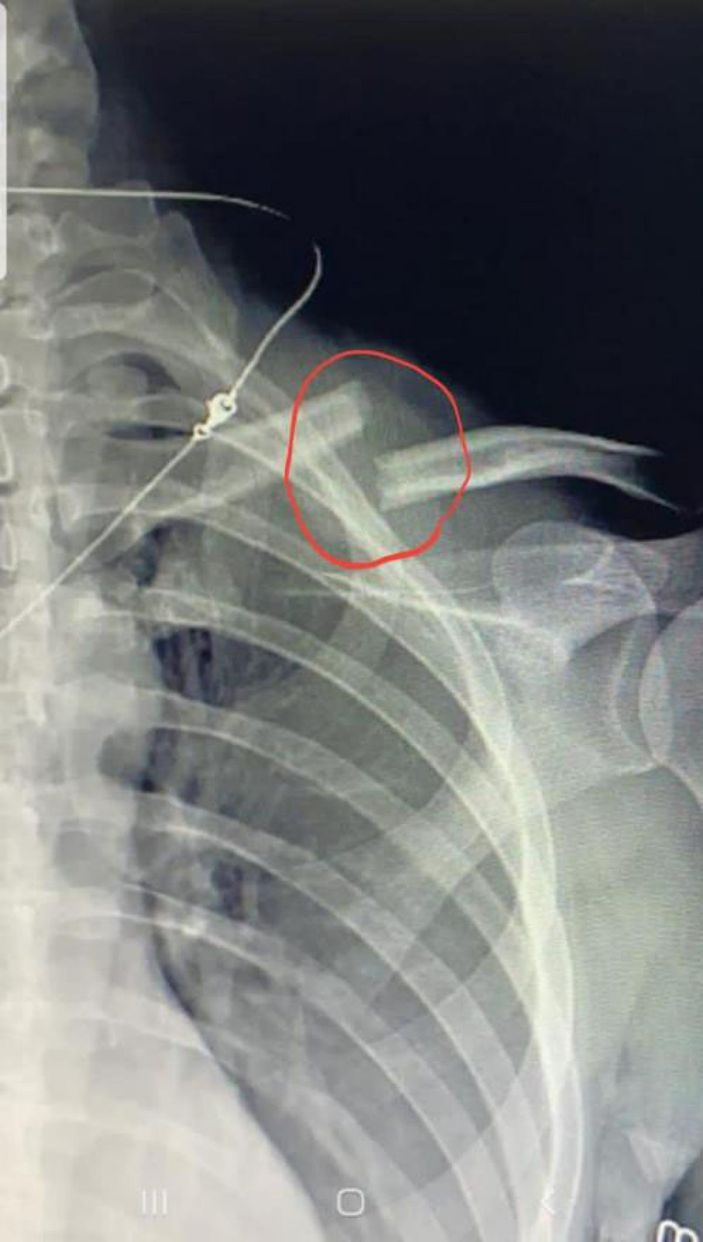 Ankara'da eşinden şiddet gören Rus kadın