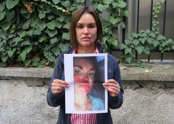 Ankara'da eşinden şiddet gören Rus kadın