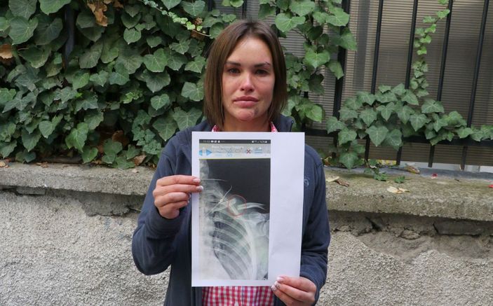 Ankara'da eşinden şiddet gören Rus kadın