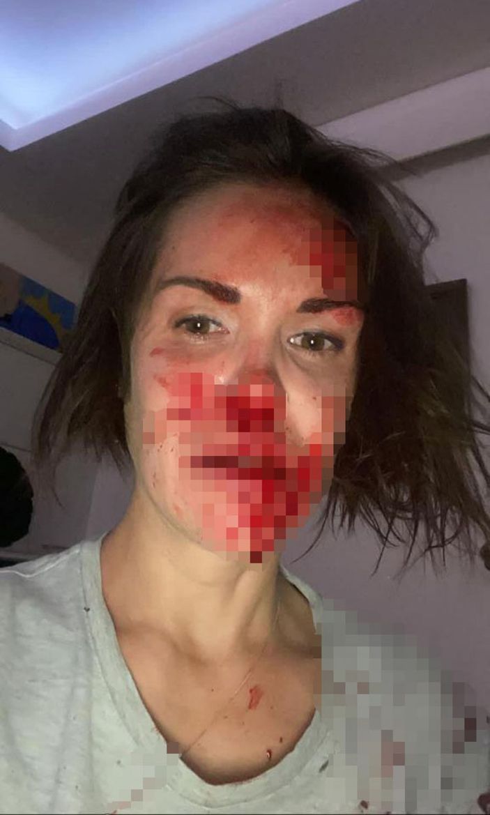 Ankara'da eşinden şiddet gören Rus kadın