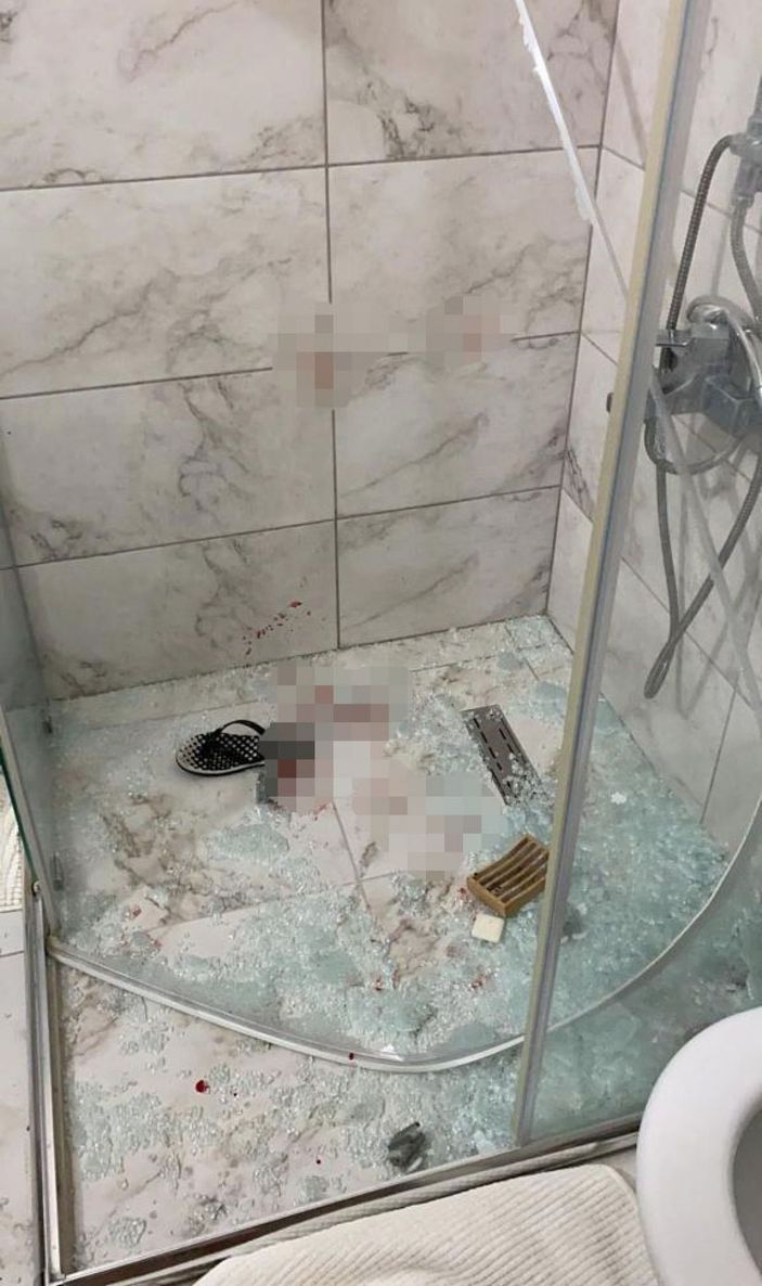 Ankara'da eşinden şiddet gören Rus kadın