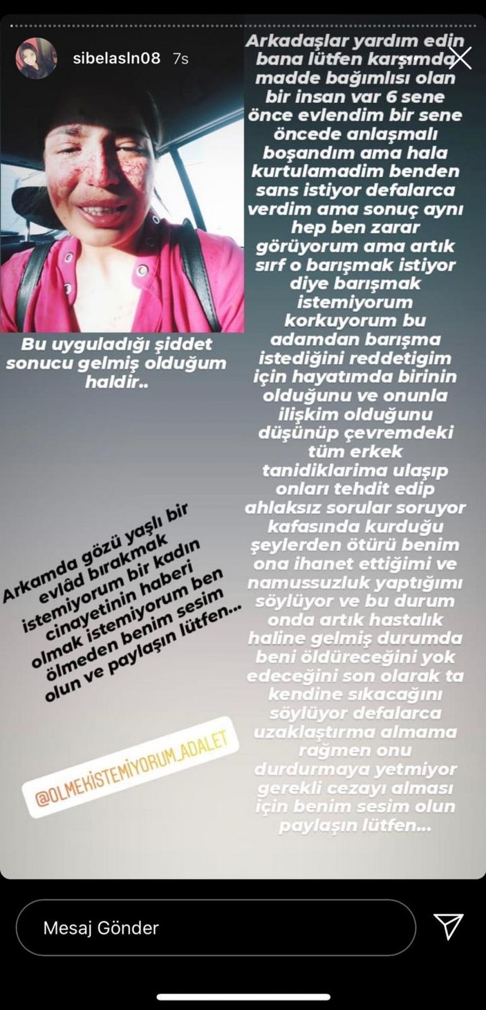 Boşandığı eşinden şiddet gören Sibel, sosyal medyadan yardım istedi -2