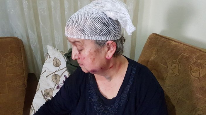 Yaşlı kadını darp edip bileziklerini gasbeden şüpheli komşusu çıktı -5