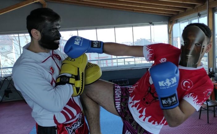Yüzlerini siyaha boyayarak ırkçılığı protesto ettiler -3