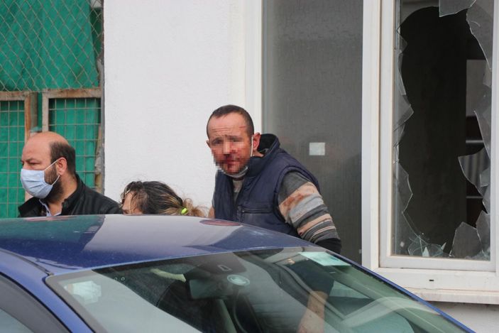 Denizli'de komşusunun kulağını ısırarak kopardı 