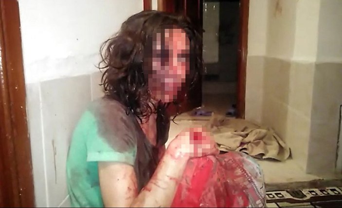 Antalya'da eşinden ölümcül şiddet gören kadının komşuları: Bu ilk değil