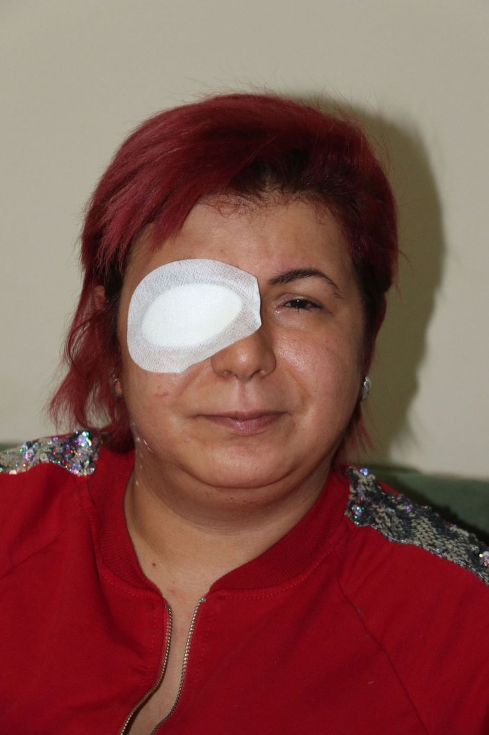 Alerji olan kadının derisi döküldü, sağ gözü görme kaybı yaşadı -1