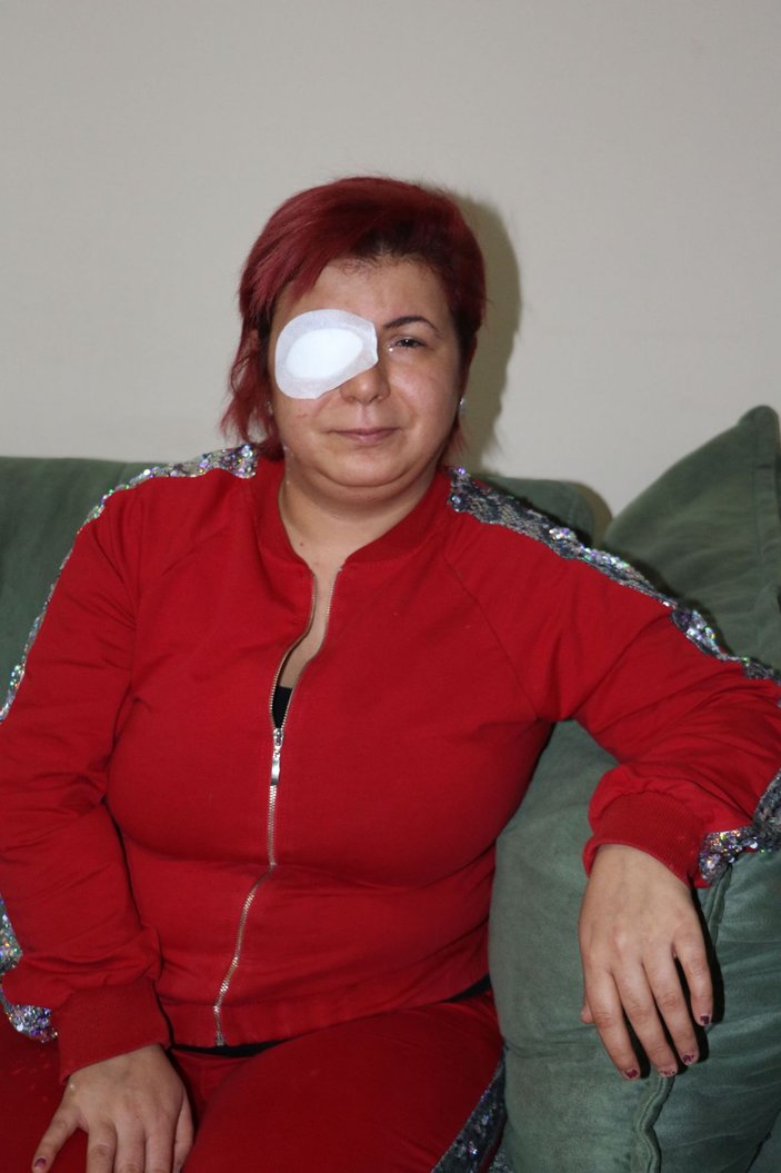 Alerji olan kadının derisi döküldü, sağ gözü görme kaybı yaşadı -2