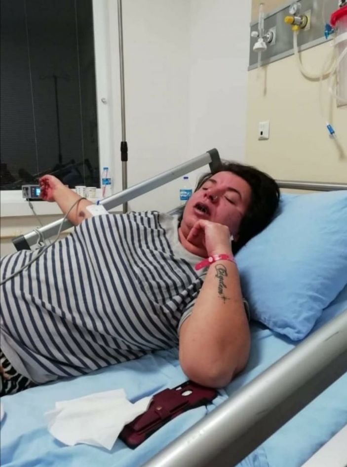 Alerji olan kadının derisi döküldü, sağ gözü görme kaybı yaşadı -9