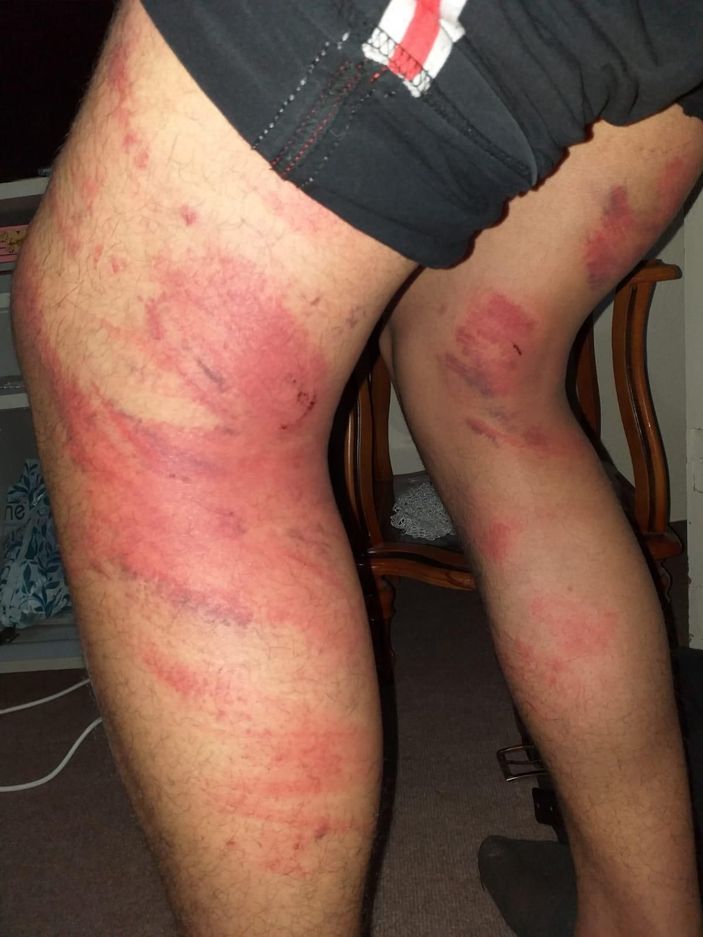 Triger kayışıyla dayak yiyen çırak: Ben dayak yediğimle usta dövdüğüyle kaldı -2