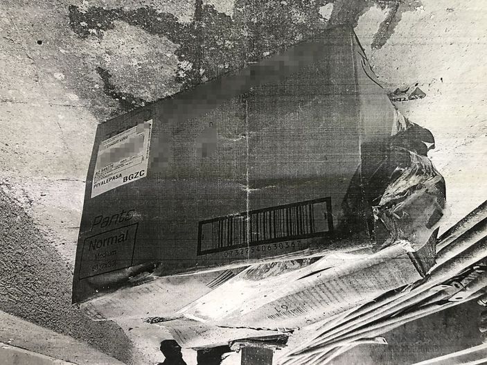 Kayıp 'dalak' için İl Sağlık Müdürlüğü soruşturma başlattı -5