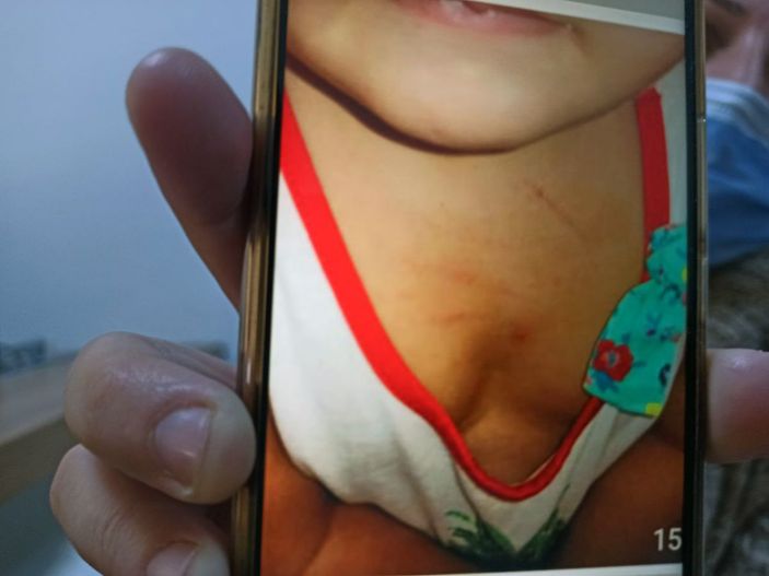 d Kreşteki şiddeti, oyuncağın içine yerleştirilen ses kayıt cihazı ortaya çıkardı -3