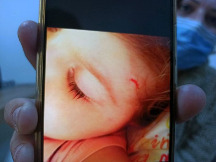 d Kreşteki şiddeti, oyuncağın içine yerleştirilen ses kayıt cihazı ortaya çıkardı -2