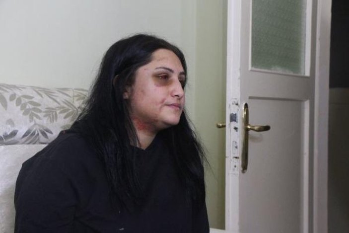 Samsun'da eski eşinin dövdüğü kadın: Şiddet sessiz kalındıkça çoğalıyor -4