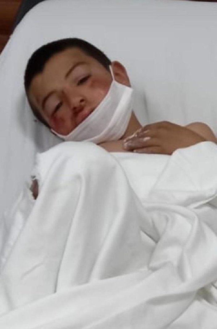 İzmir'de yola fırlayan Suriyeli çocuk aracın altında kaldı