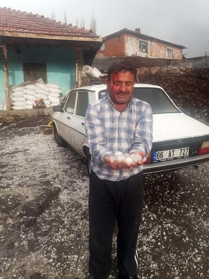 Yozgat'ta ceviz büyüklüğündeki dolu hastanelik etti -4