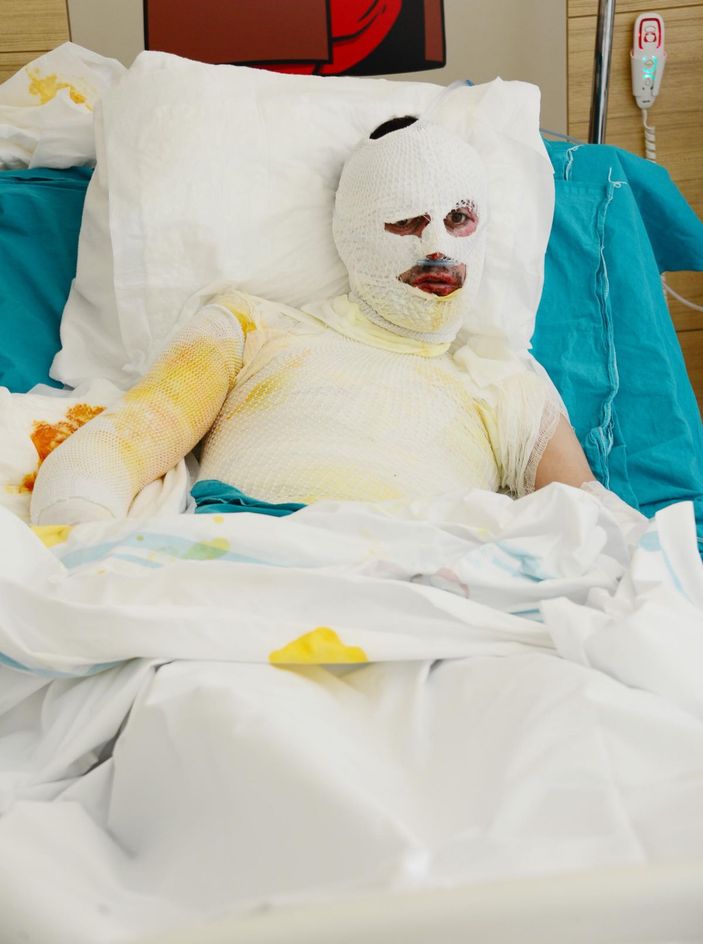 d Üzerine yıldırım düşen çoban ağır yaralandı -4