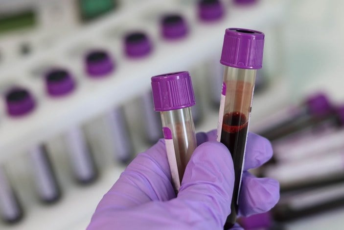 Bilim insanları, 50 kanser türünü doğru tespit eden kan testinin analizini yaptı  -2