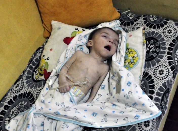 d Sürekli kilo kaybeden Mustafa bebek, hayata tutunamadı -2