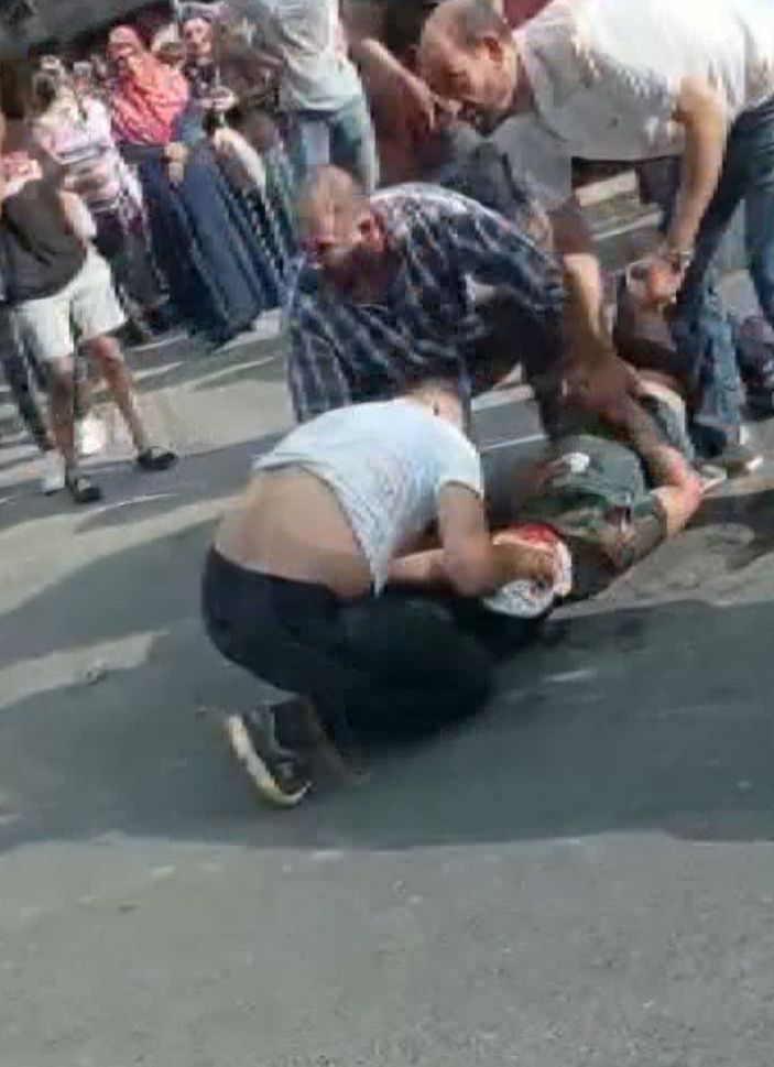 d Sultangazi'de otomobilin çarptığı 14 yaşındaki çocuk ağır yaralandı -1