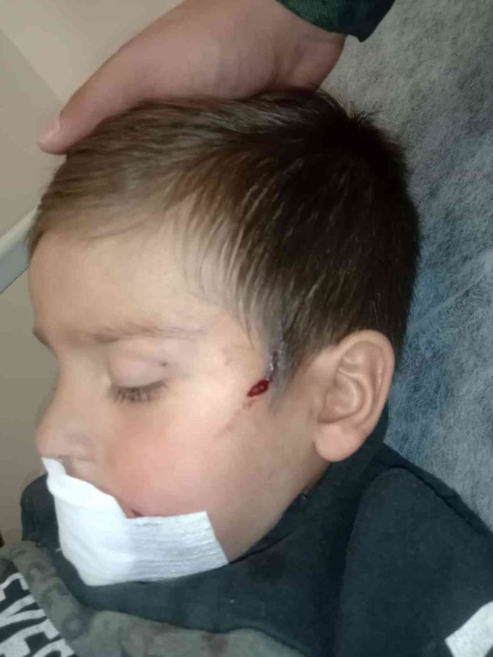 Köpeğin saldırısına uğrayan 3 yaşındaki çocuk ölümden döndü -11