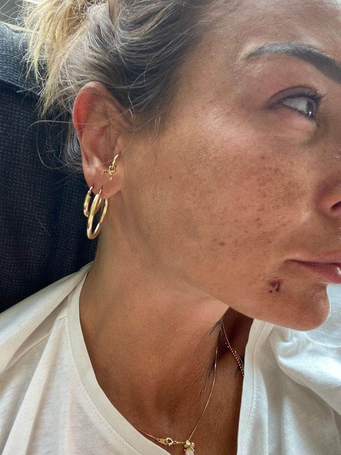 d Eski sevgiliye dayağa 12 yıl hapis istemi -2