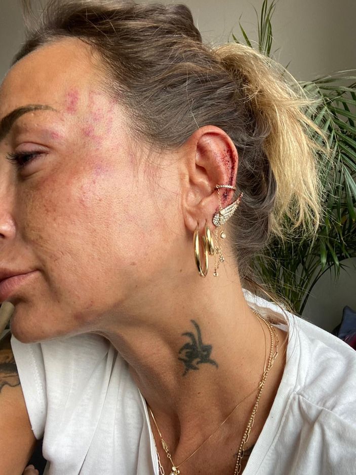 Eski sevgiliye dayağa 12 yıl hapis istemi -3