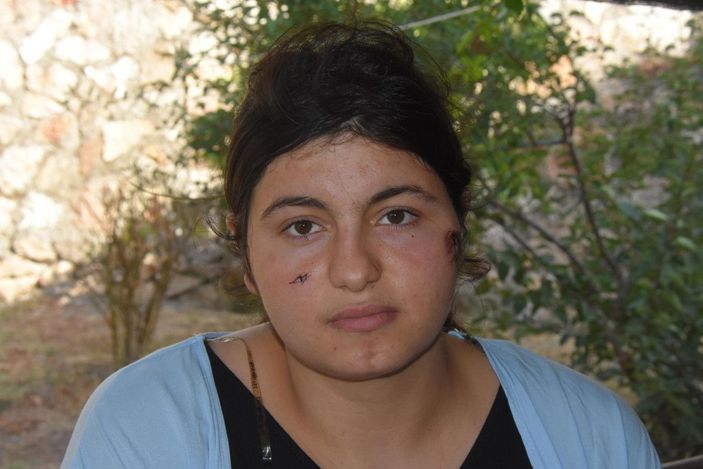 Mahkemenin 'eşe dayak' değerlendirmesi: Yaralama değil öldürmeye teşebbüs -2