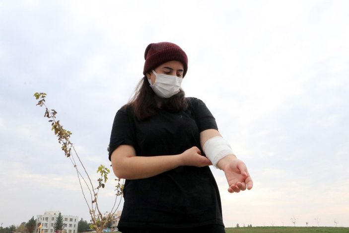 Üniversiteli Rojin, kampüste köpeklerin saldırısına uğradı -1