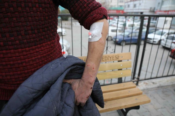 Gaziantep'te 1 kişinin yaralandığı Pitbull saldırısına 2 gözaltı -2