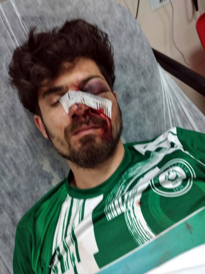 Kırmızı kart gören futbolcu, yerde yatan rakibinin yüzüne tekme atıp yaraladı -3