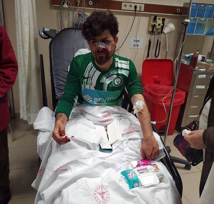 Kırmızı kart gören futbolcu, yerde yatan rakibinin yüzüne tekme atıp yaraladı -2