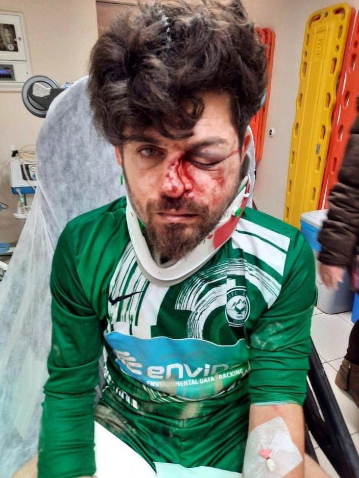 Kırmızı kart gören futbolcu, yerde yatan rakibinin yüzüne tekme atıp yaraladı -1