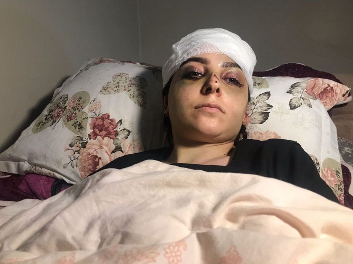 Sultangazi'de tayt dayağı: Karısını hastanelik etti, serbest kaldı -6