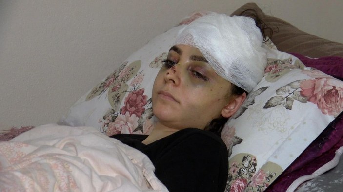 Sultangazi'de tayt dayağı: Karısını hastanelik etti, serbest kaldı -10
