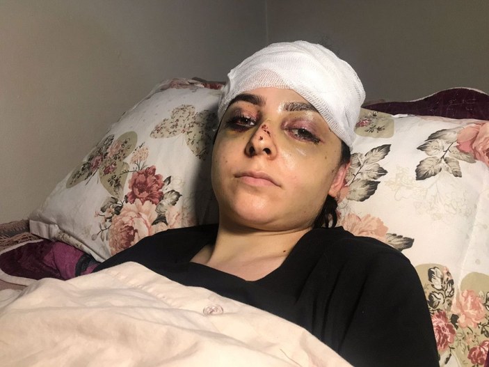 Sultangazi'de tayt dayağı: Karısını hastanelik etti, serbest kaldı -7