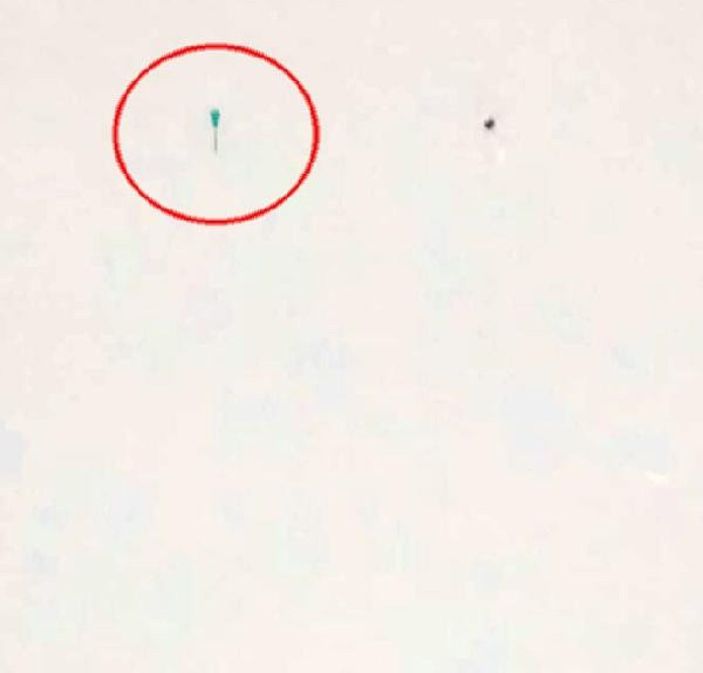 Adli muayene için getirilen 2 şüphelinin saldırdığı doktor yaralandı -8