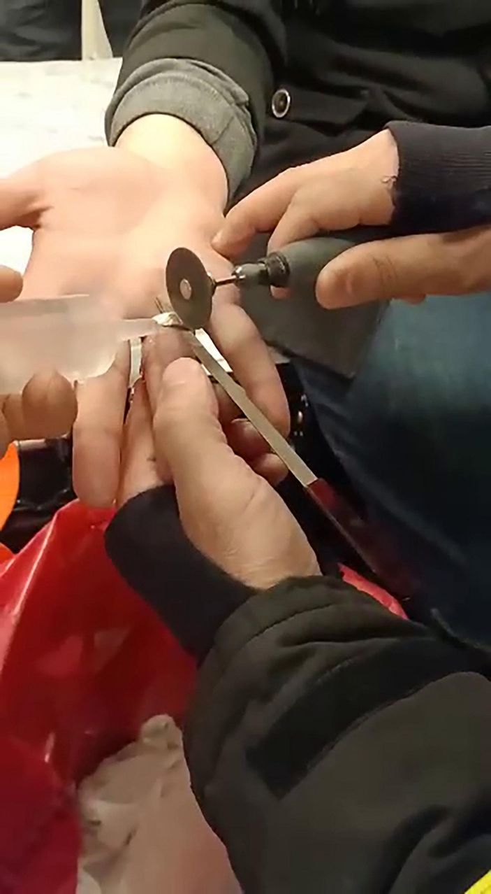 Acil serviste itfaiyeden 'yüzük' operasyonu -4