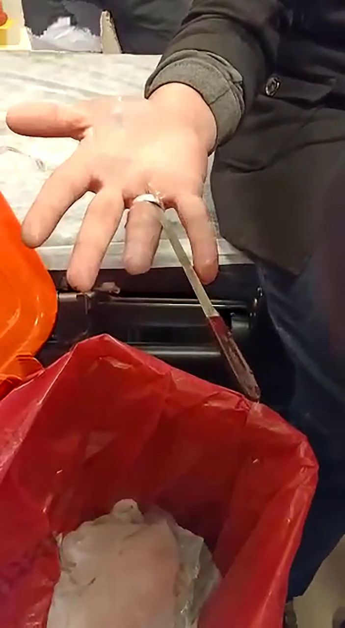 Acil serviste itfaiyeden 'yüzük' operasyonu -3