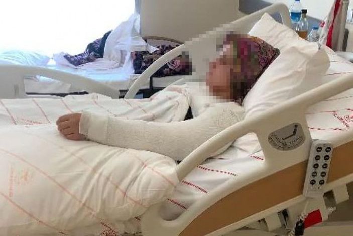 d Kimyasallı saldırıya uğrayan Merve: Yüzüme attığı sıvı, kapının boyasını dahi eritmiş -1