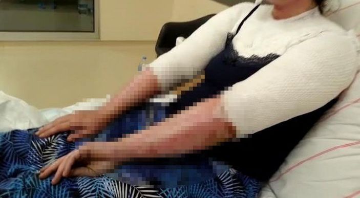 d Kimyasallı saldırıya uğrayan Merve: Yüzüme attığı sıvı, kapının boyasını dahi eritmiş -3