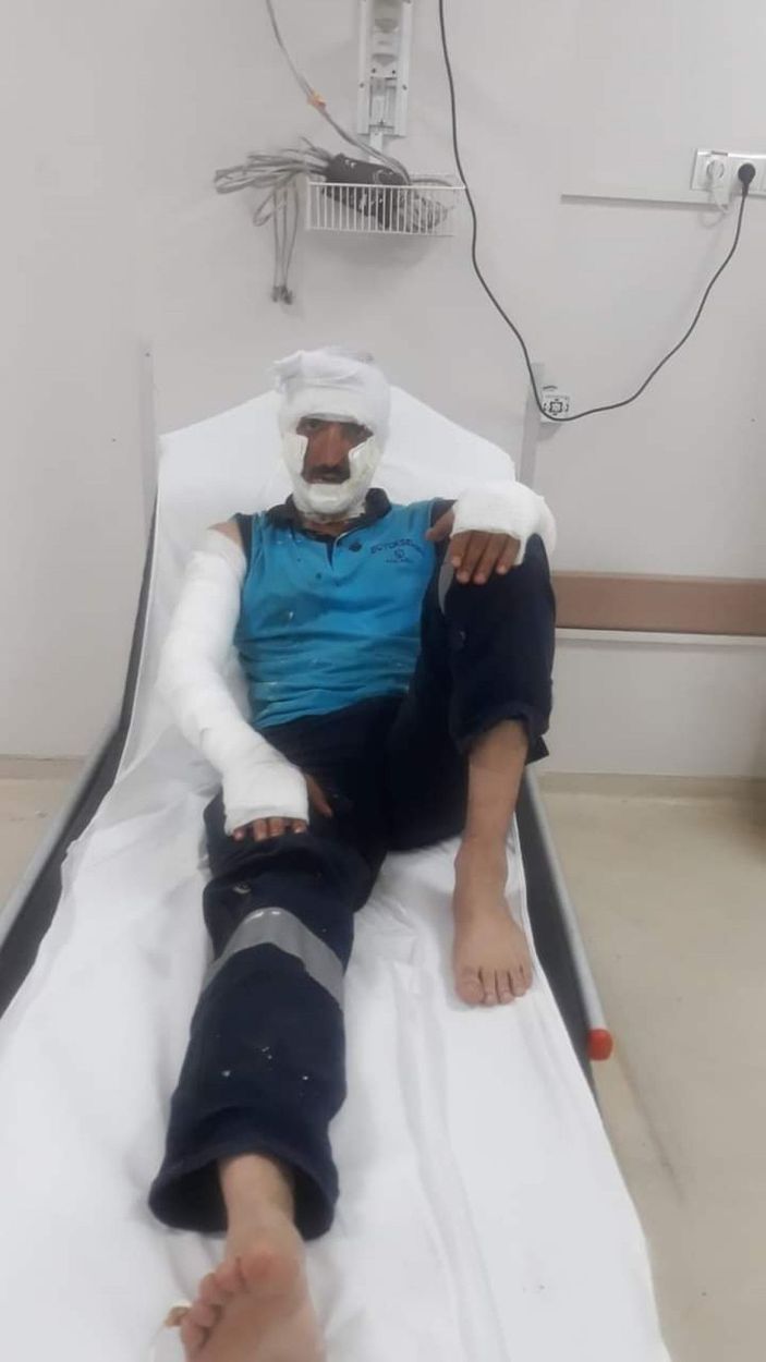 d Rögar kapağına kaynak sırasında patlama: 2 işçi yaralı -1